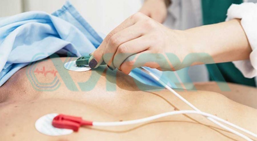 آزمایش نوار قلب